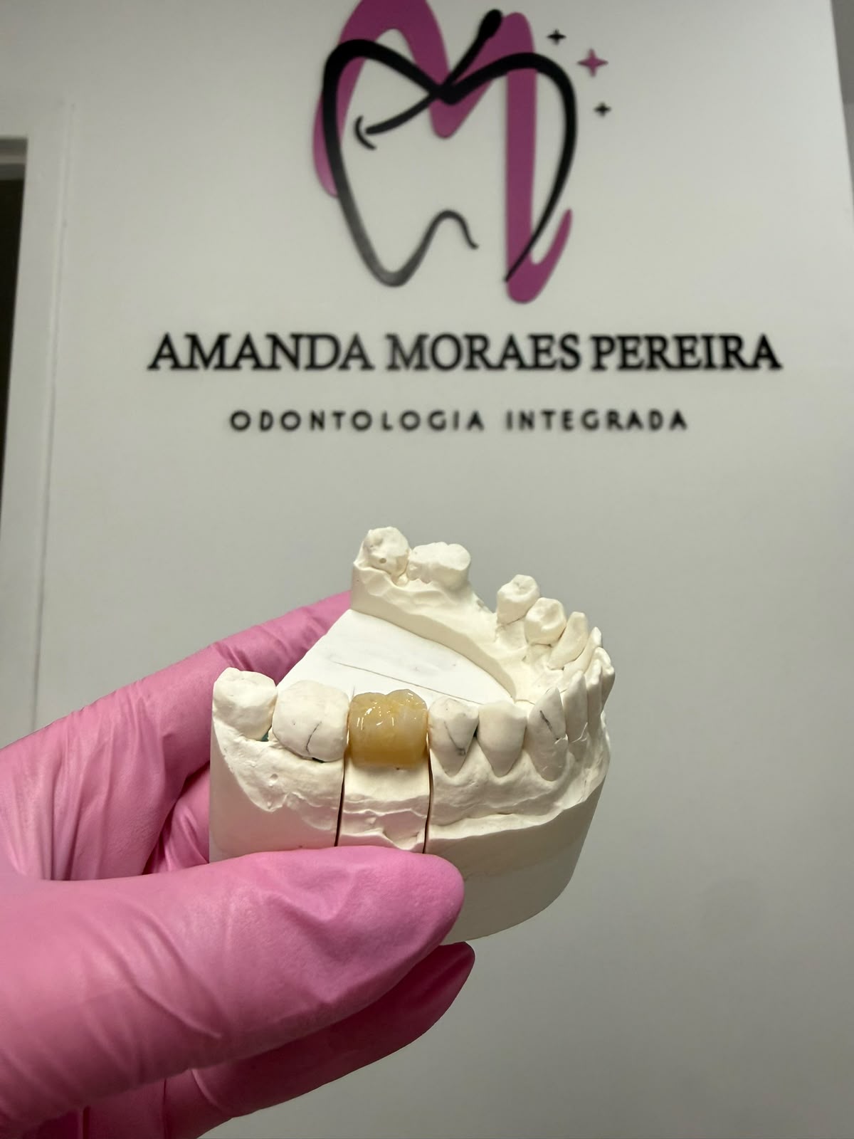 Modelo odontológico de prótese